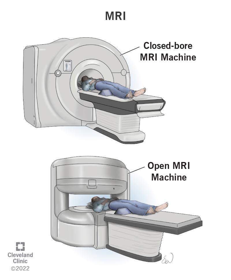 4876-mri-1
