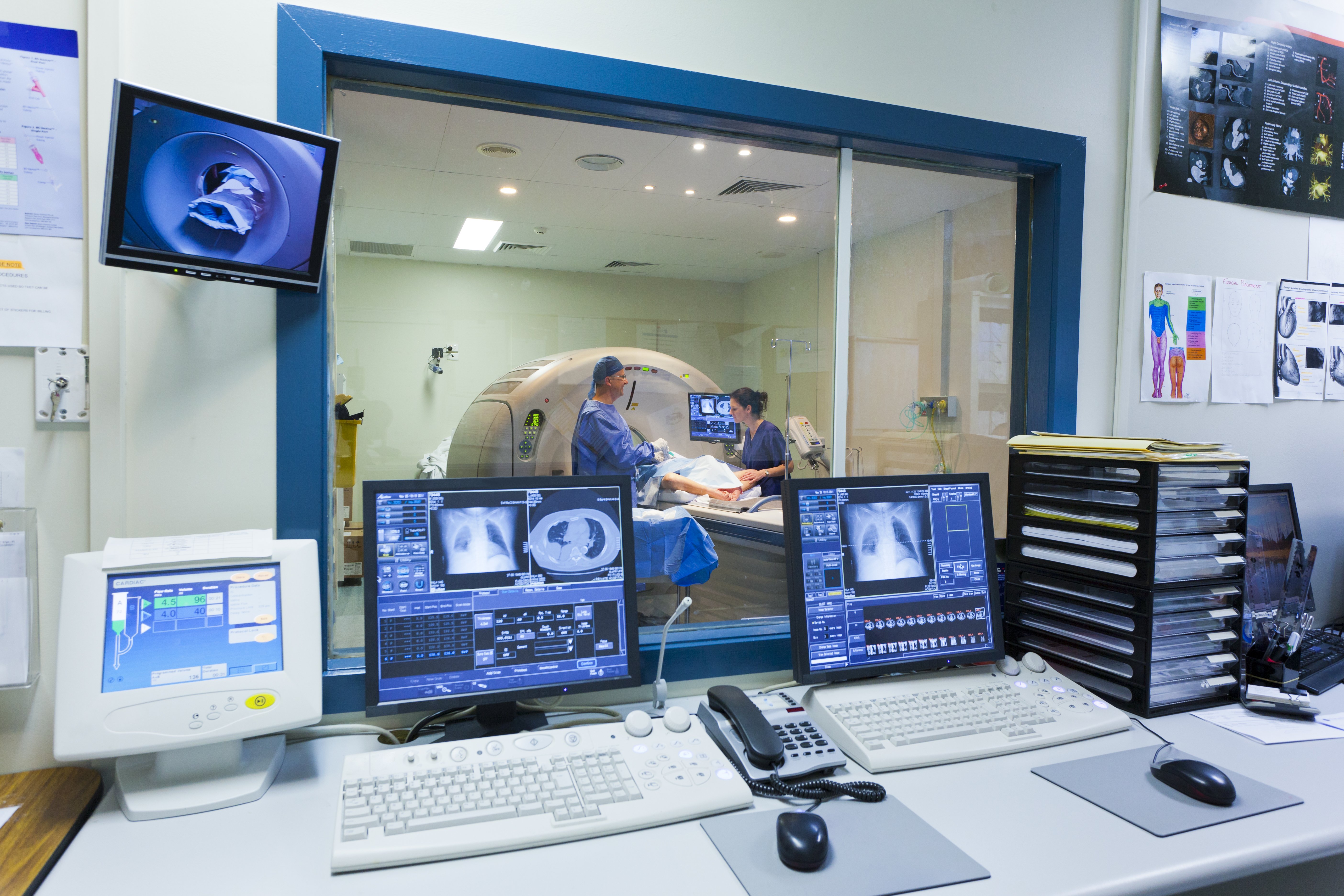 Control room of a MRI machine featuring computers with lung scans.